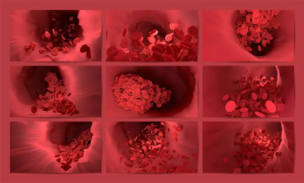 Fraxiparine